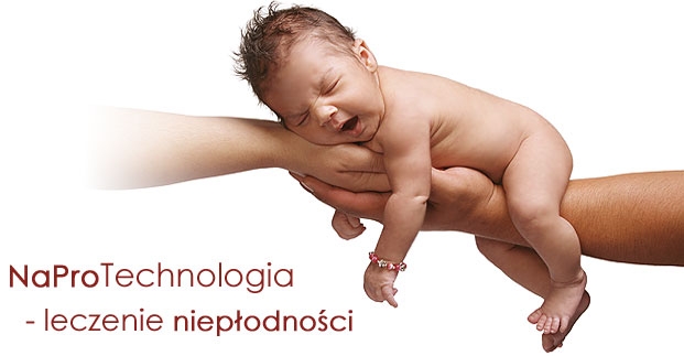 napro